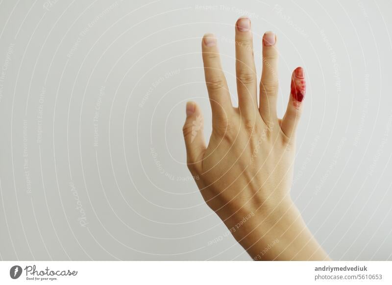 Female hand with red blood, little finger is bleeding profusely. Woman injured her little finger at home with knife or other sharp object. Bleeding wound and body injury result. Domestic accident.