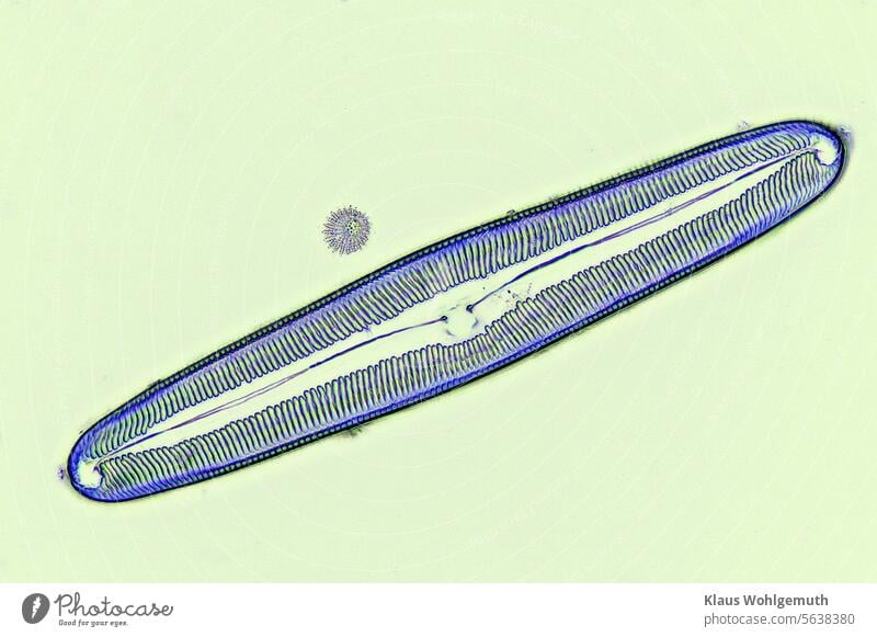 Diatom (Pinnularia? ) negative of a dark field image. microscopy structures and shapes