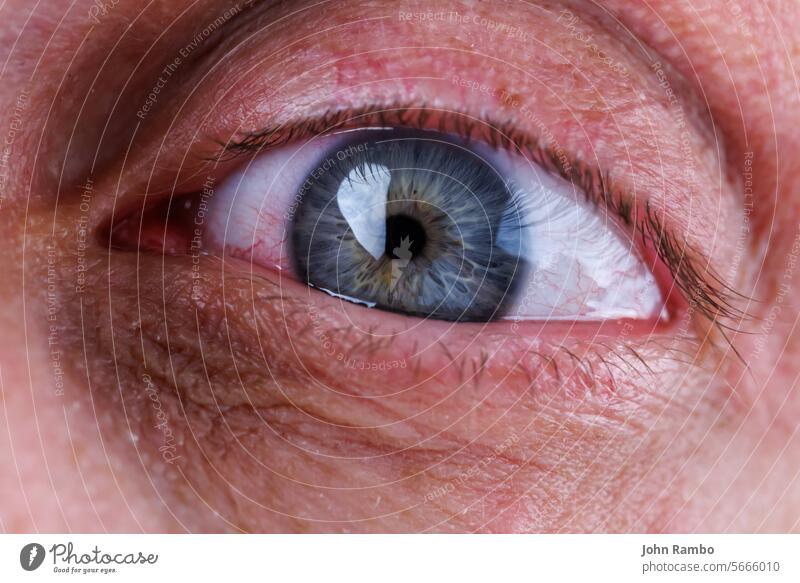 gray eye of caucasian male with red capillary mesh closeup macro view tired inflammation baggy baggy skin europeoid eyeball eyelash allergy human eyesight iris