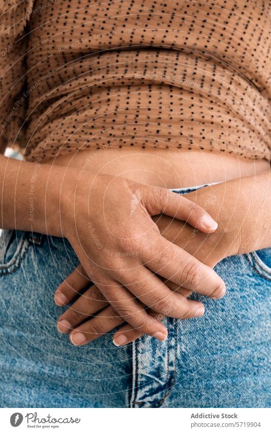 A detailed view of anonymous person's hands clasped together, one showcasing a post-surgical adaptation where thumbs are absent, resting on denim jeans grip