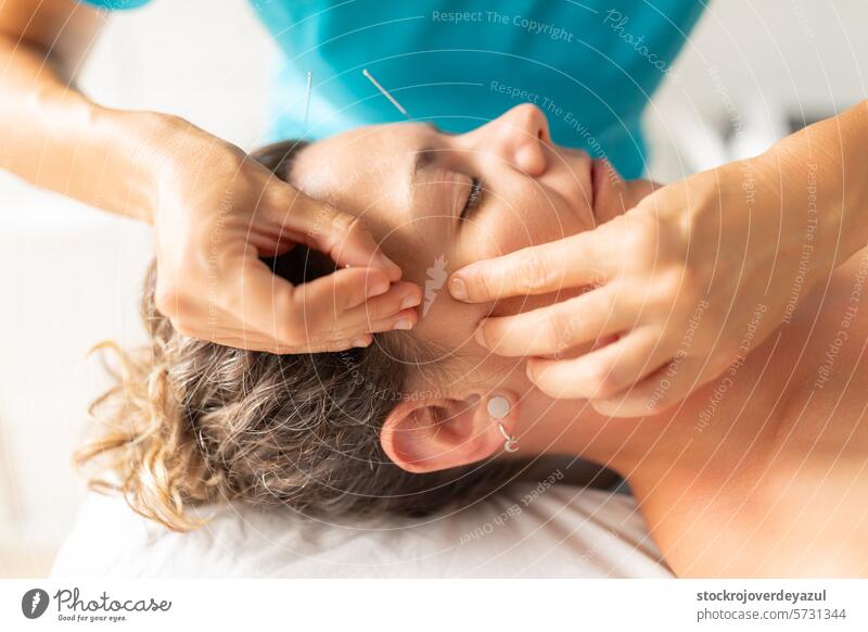 A physiotherapist performs a facial acupuncture session on her patient to tone the muscles of the face clinic rehabilitation health care physiotherapy treatment