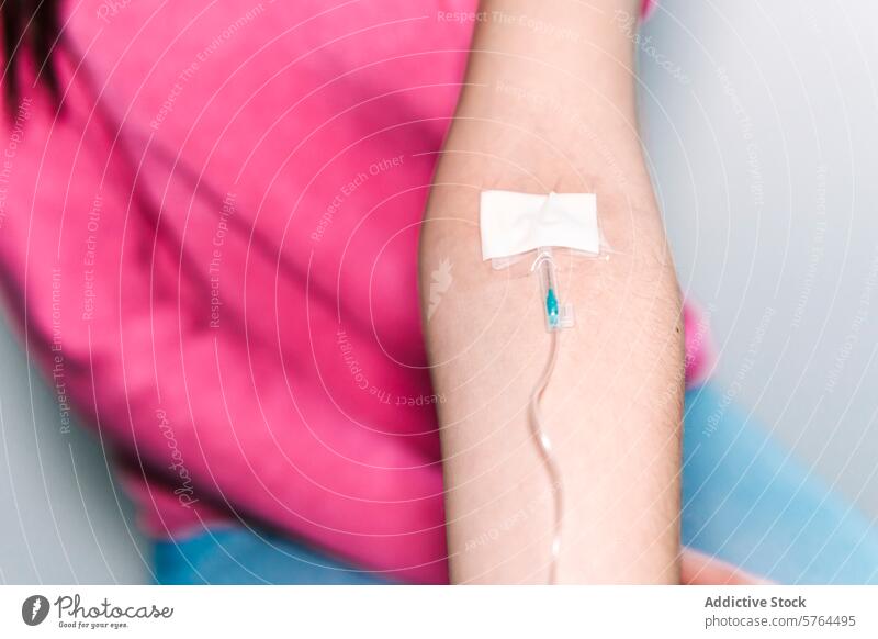 A close-up view of a patient's arm with a securely placed intravenous line, the adhesive tape ensuring minimal movement for proper medication administration IV