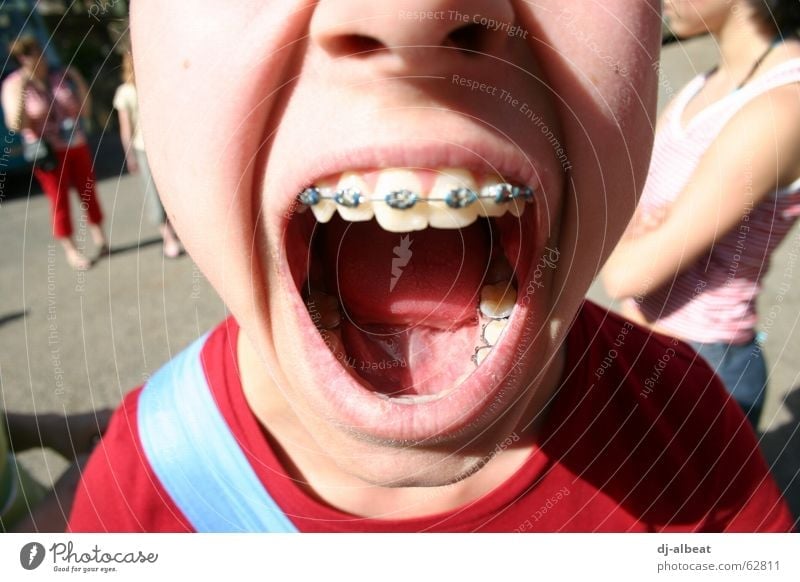 Open your mouth! Braces Girl Glittering Loud Red Protest Exterior shot Healthy Anger Aggravation Child Mouth Silver Tongue Lips Scream Blue Skin Nose