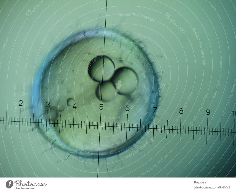 Japanese rice peeled or Medaka III Zoology Internship Microscope Discover Embryo Chorion Development Growth Academic studies Biology Scale Looking Egg